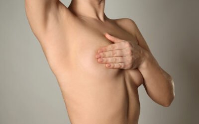 Mamoplastia SHORT SCAR