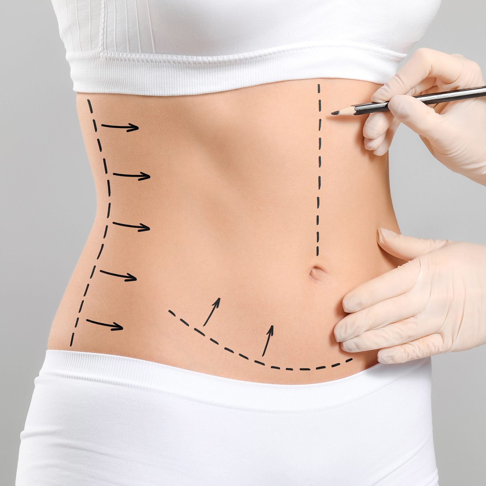 Plastic surgeon applying marks on woman's body against grey background